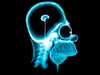Homer Simpson - Radiografía cerebro hueco